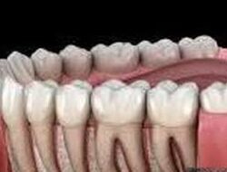 Tips Kesehatan Harian Agar Gigi Tetap Kuat Sehat Bersih Dan Bebas Masalah