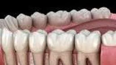 Tips Kesehatan Harian Agar Gigi Tetap Kuat Sehat Bersih Dan Bebas Masalah